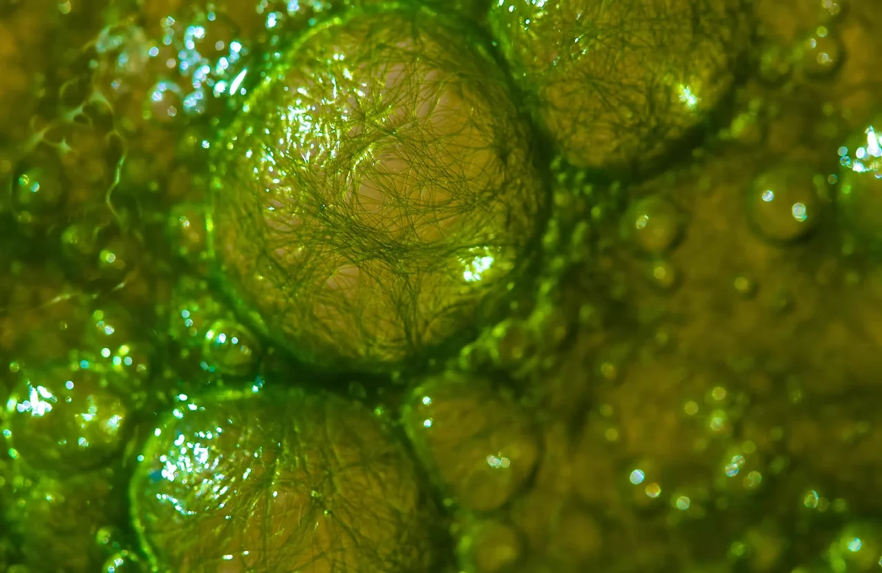 Algal DHA